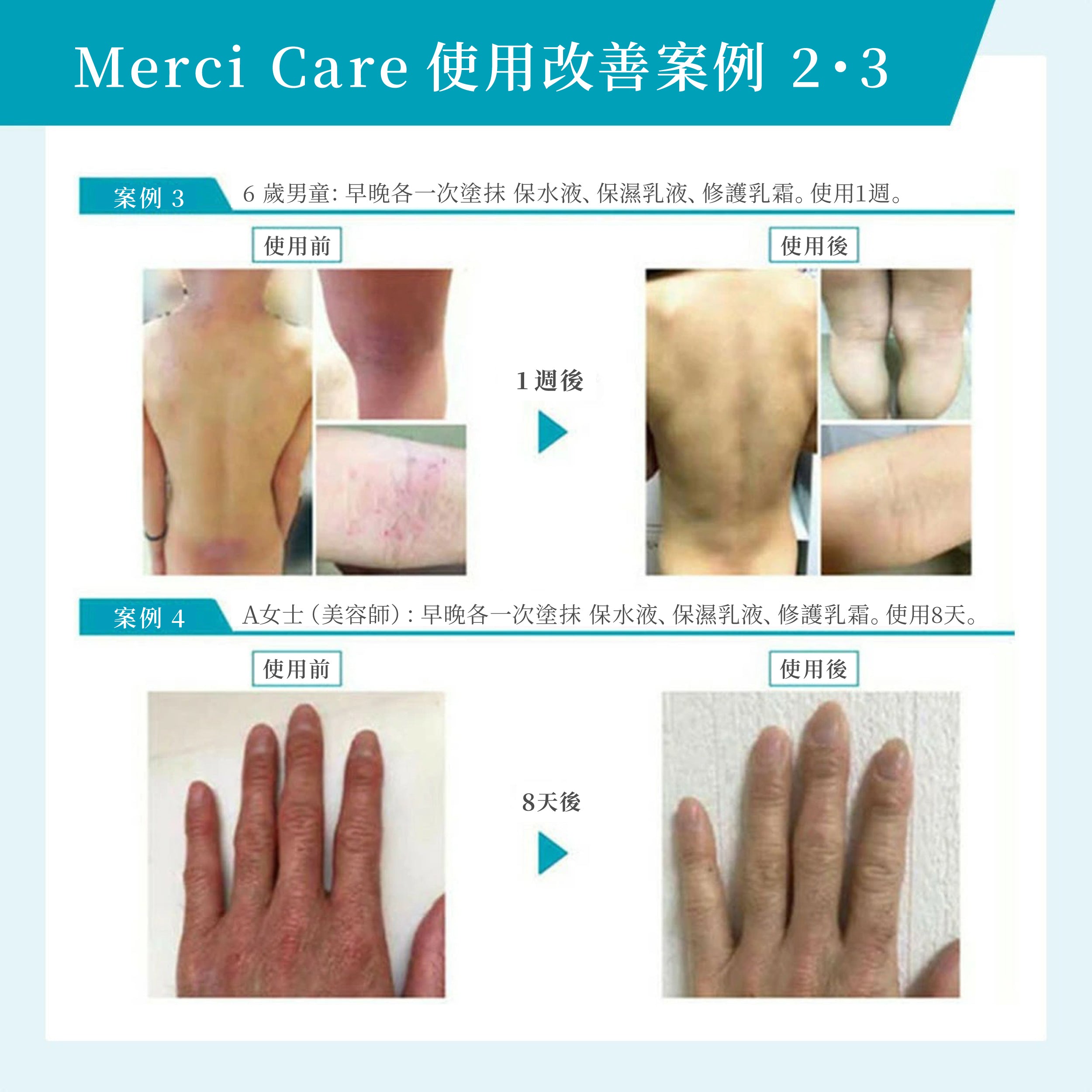 MerciCare護膚系列