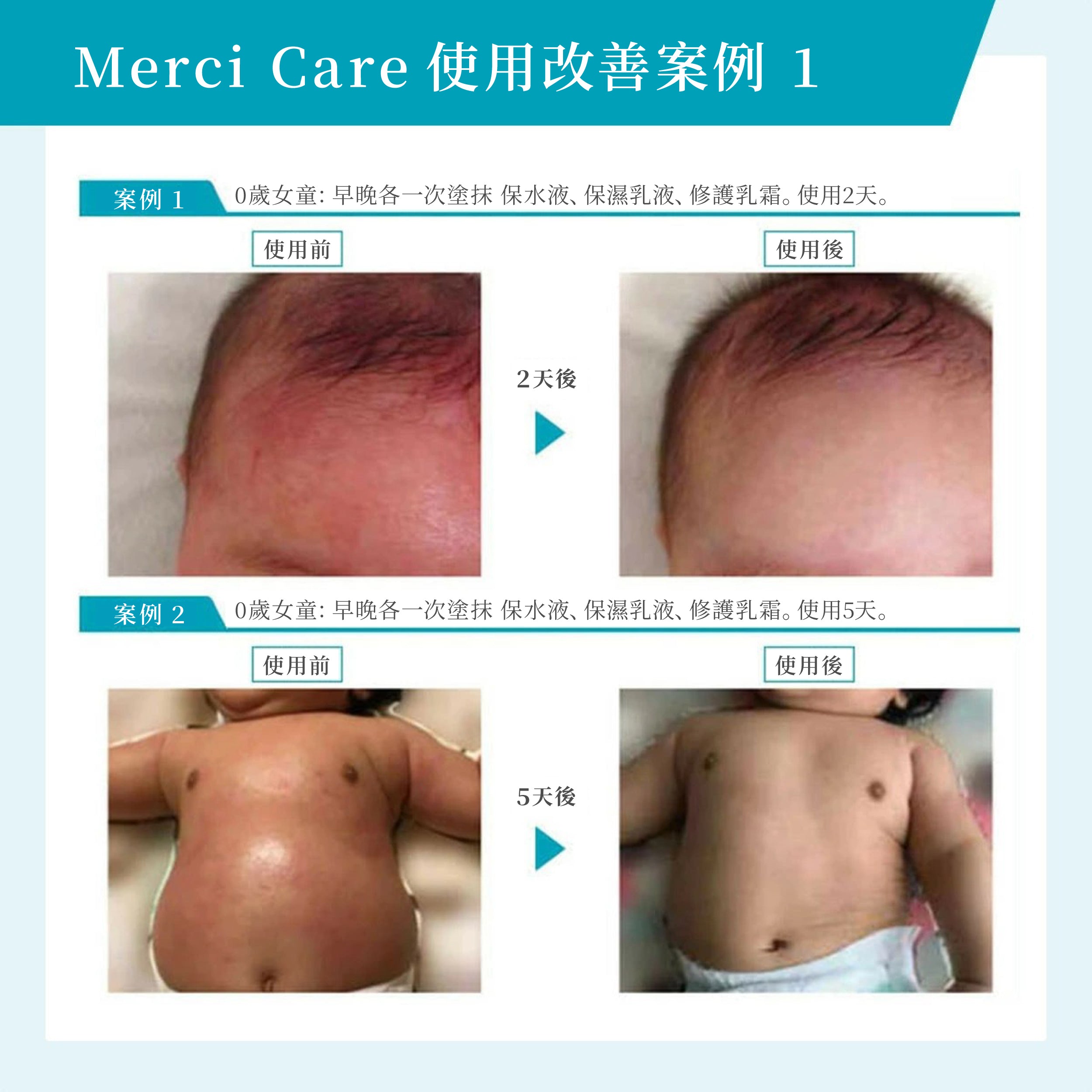 MerciCare護膚系列